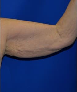Case 2 - Before