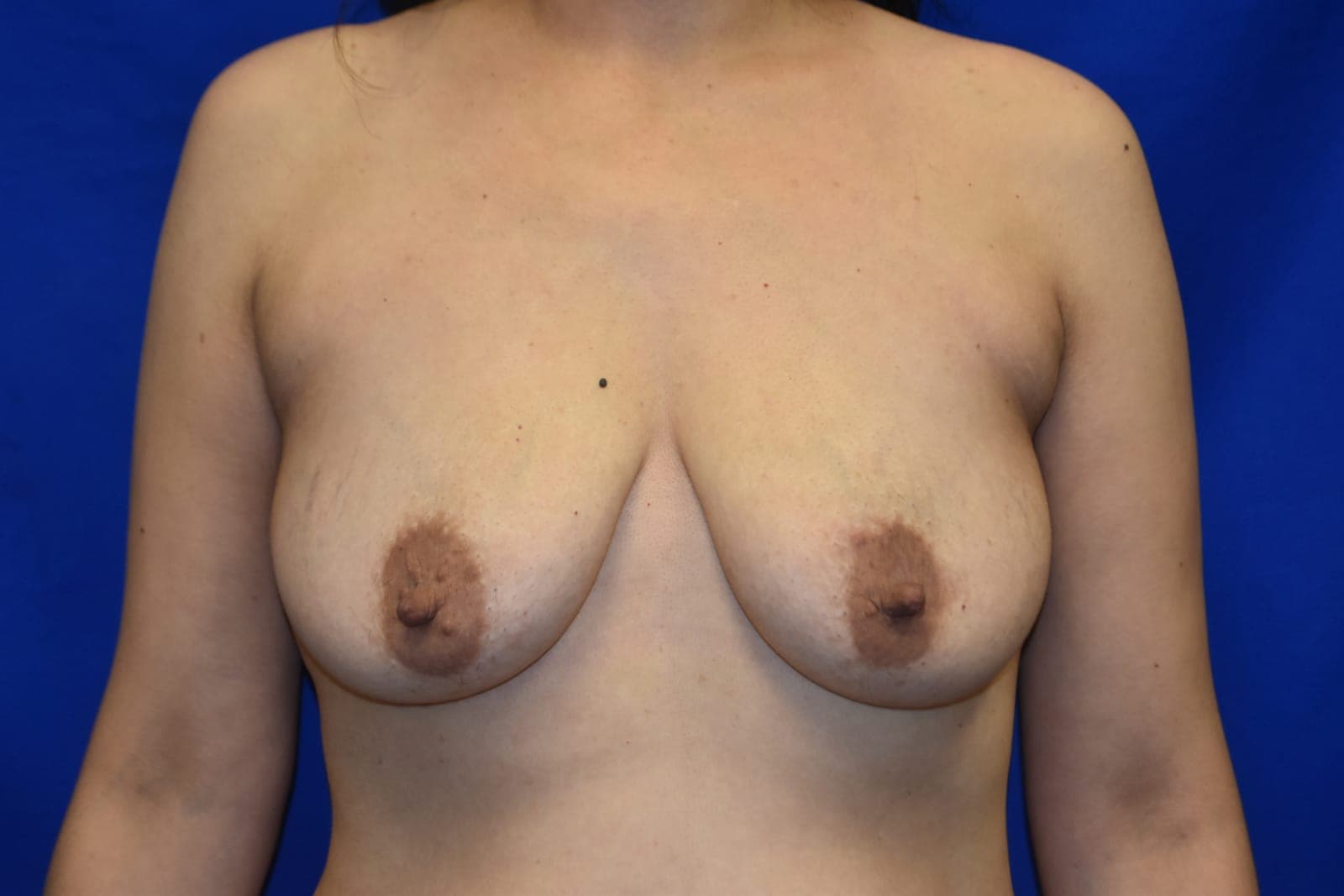 Case 1 - Before