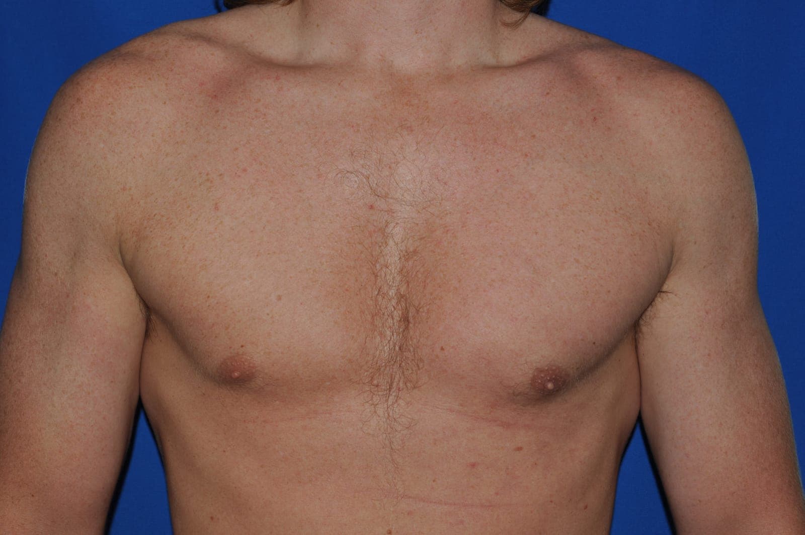 Case 1 - After