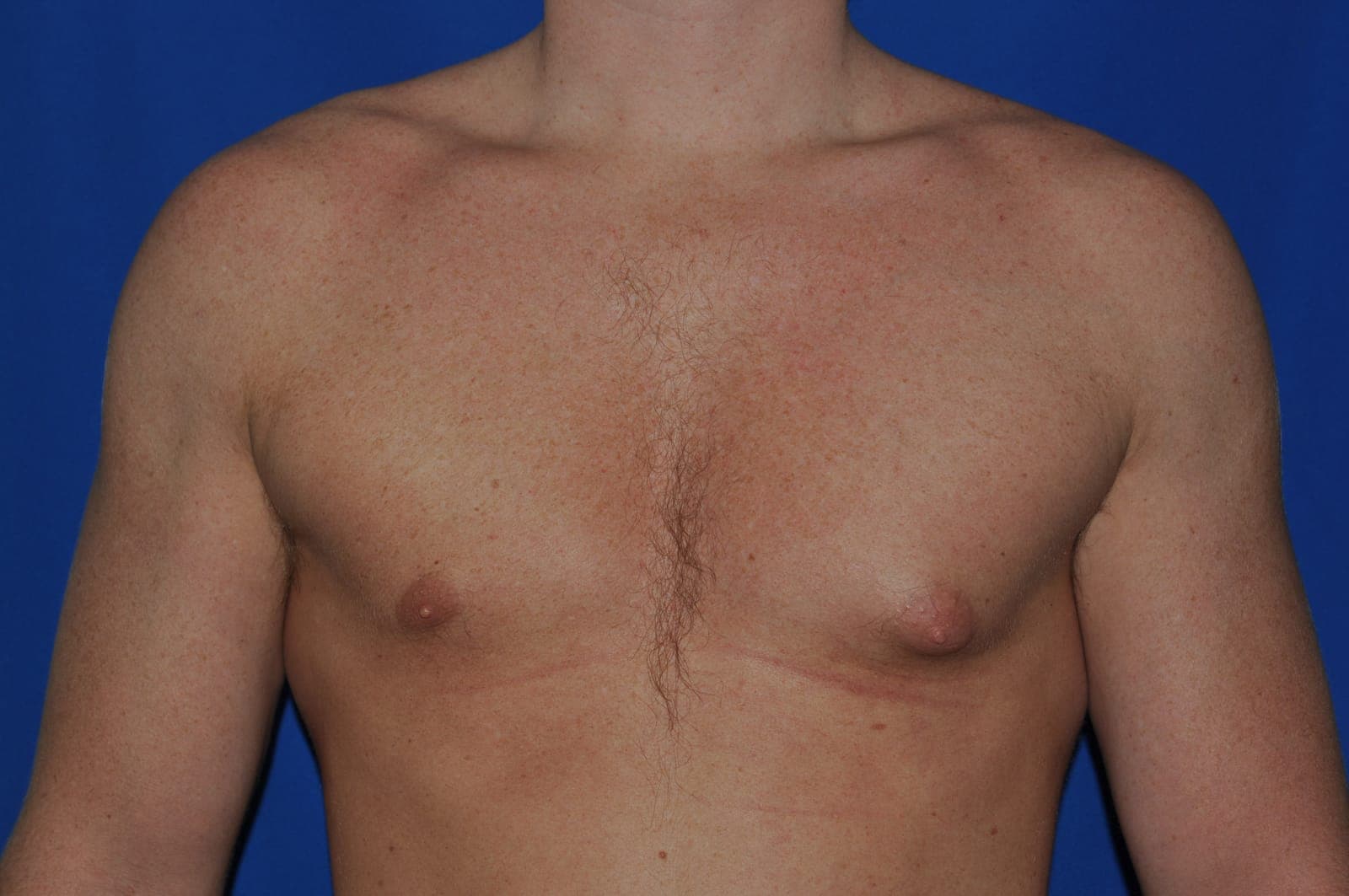Case 1 - Before