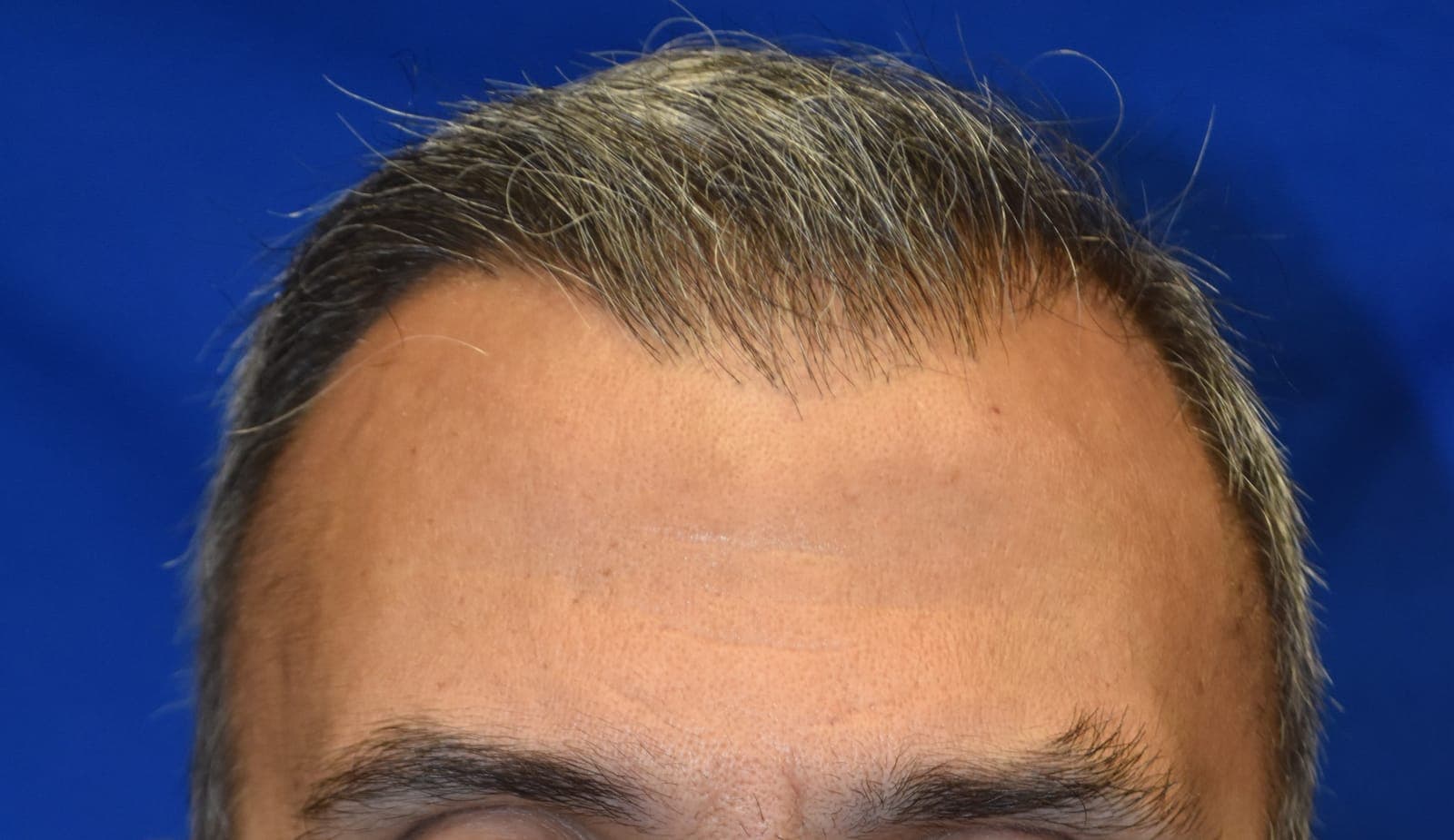 Case 1 - After