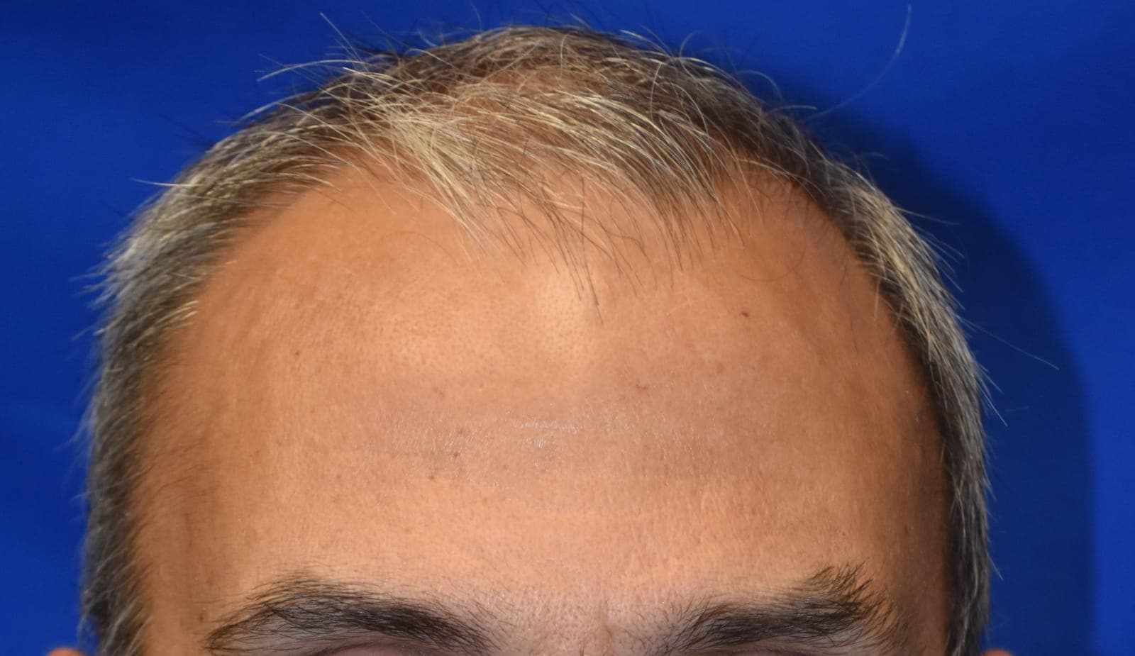 Case 1 - Before