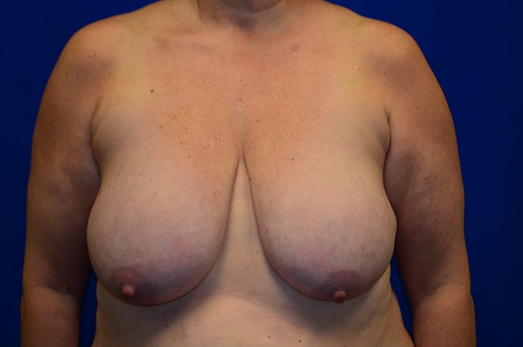 Case 1 - Before
