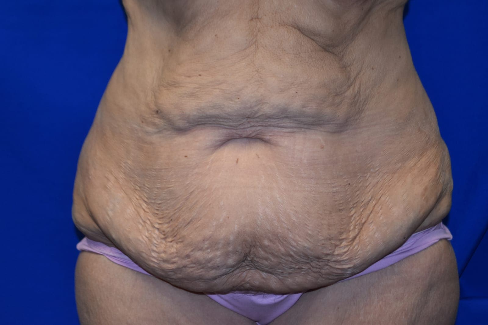 Case 2 - Before