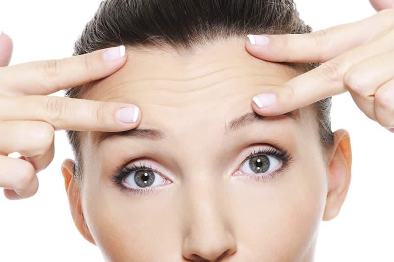 Brow Lift
