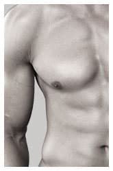 Gynecomastia Treatment