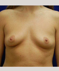 Before-front: 36A to 36C